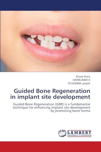 Guided Bone Regeneration in implant site development