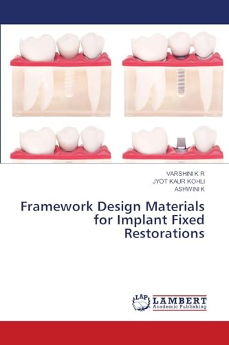 Framework Design Materials for Implant Fixed Restorations