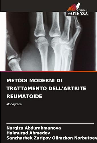 METODI MODERNI DI TRATTAMENTO DELL'ARTRITE REUMATOIDE