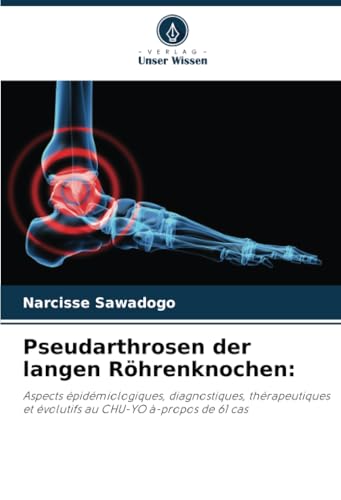 Pseudarthrosen der langen Röhrenknochen