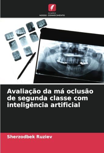 Avaliação da má oclusão de segunda classe com inteligência artificial