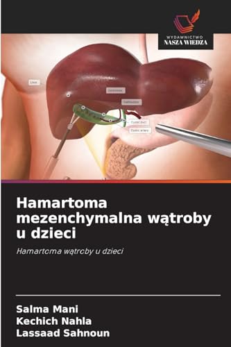 Hamartoma mezenchymalna wątroby u dzieci
