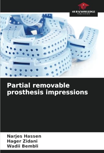 Partial removable prosthesis impressions