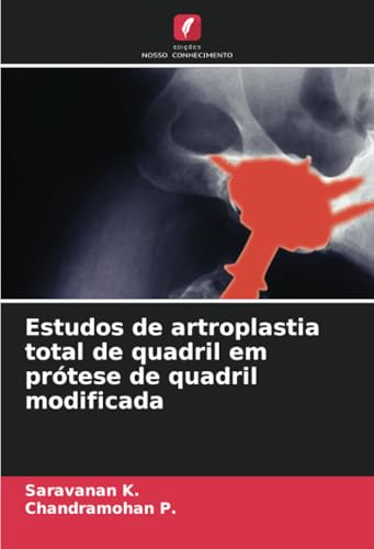 Estudos de artroplastia total de quadril em prótese de quadril modificada