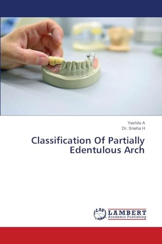 Classification Of Partially Edentulous Arch