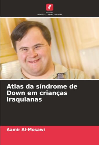 Atlas da síndrome de Down em crianças iraquianas