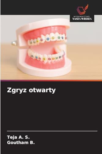 Zgryz otwarty