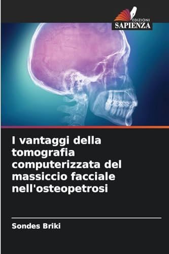 I vantaggi della tomografia computerizzata del massiccio facciale nell'osteopetrosi