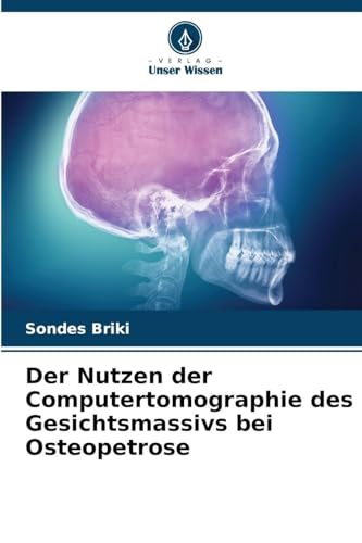 Der Nutzen der Computertomographie des Gesichtsmassivs bei Osteopetrose