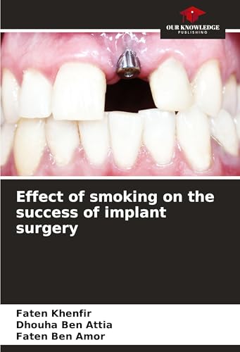 Effect of smoking on the success of implant surgery