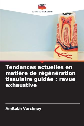 Tendances actuelles en matière de régénération tissulaire guidée
