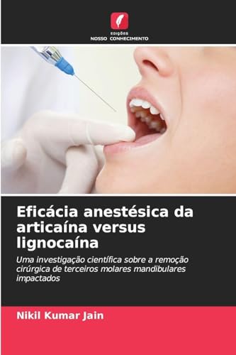 Eficácia anestésica da articaína versus lignocaína