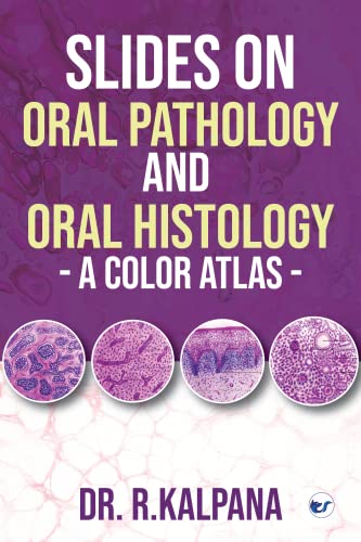 Slides on Oral Pathology and Oral Histology - A Color Atlas