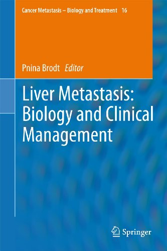 Liver Metastasis