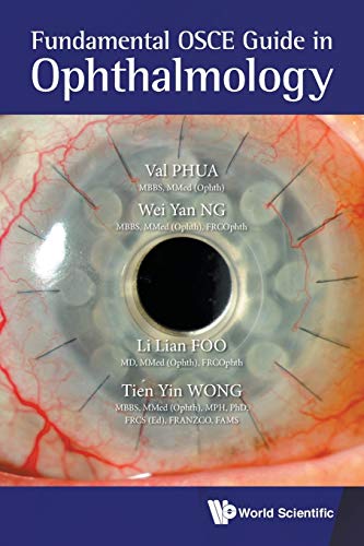 FUNDAMENTAL OSCE GUIDE IN OPHTHALMOLOGY