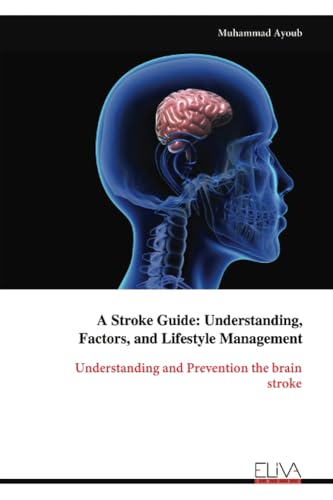 A Stroke Guide