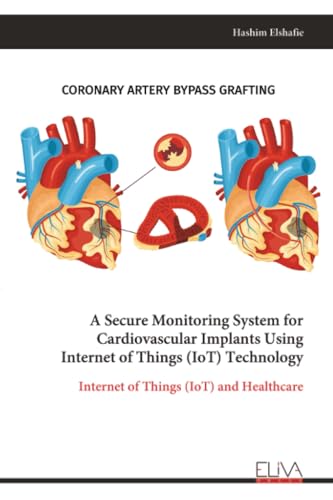 A Secure Monitoring System for Cardiovascular Implants Using Internet of Things (IoT) Technology