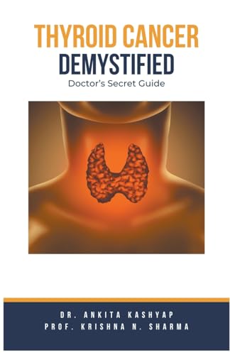 Thyroid Cancer Demystified Doctors Secret Guide