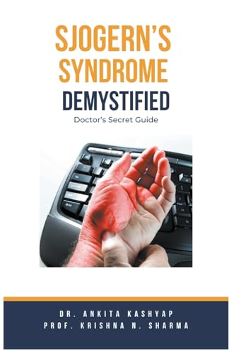 Sjogern's Syndrome Demystified Doctors Secret Guide
