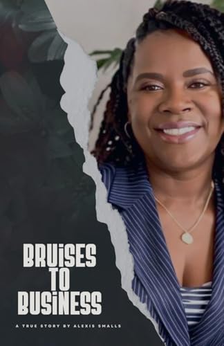Bruises 2 Business