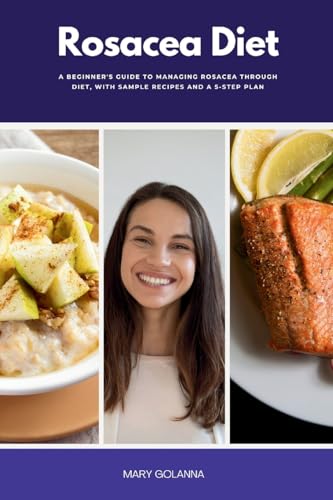 Rosacea Diet