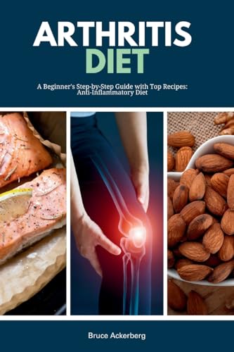 Arthritis Diet