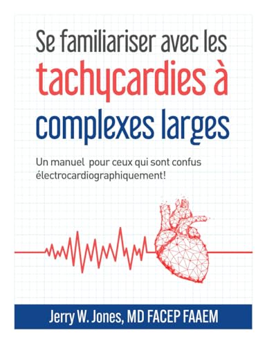 Se familiariser avec les tachycardies à complexes QRS larges