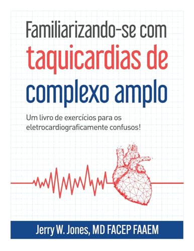 Familiarizando-se com taquicardias de complexo amplo